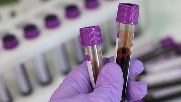 Test tubes for laboratory testing